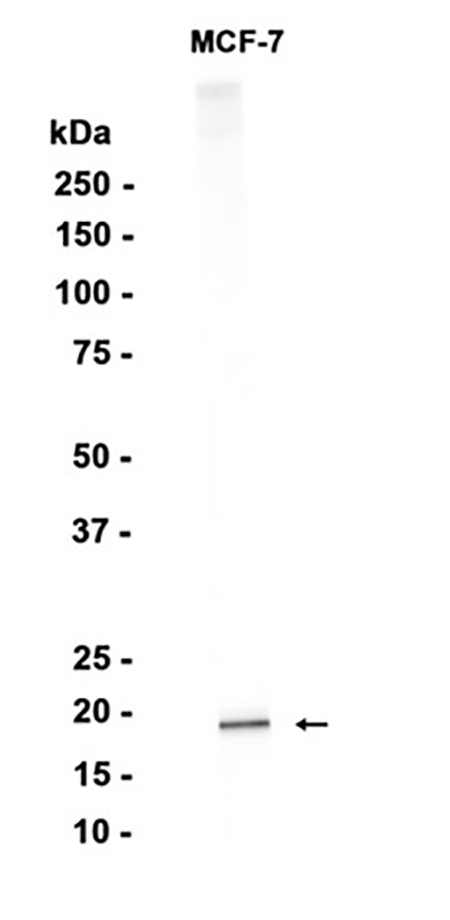 Ferritin Light Chain (10S14)兔单抗,Ferritin Light Chain (10S14) Rabbit Monoclonal Antibody