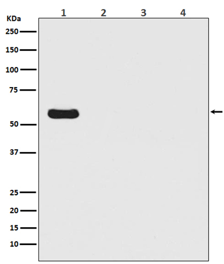 Firefly Luciferase (13Z19)兔单抗,Firefly Luciferase (13Z19) Rabbit Monoclonal Antibody