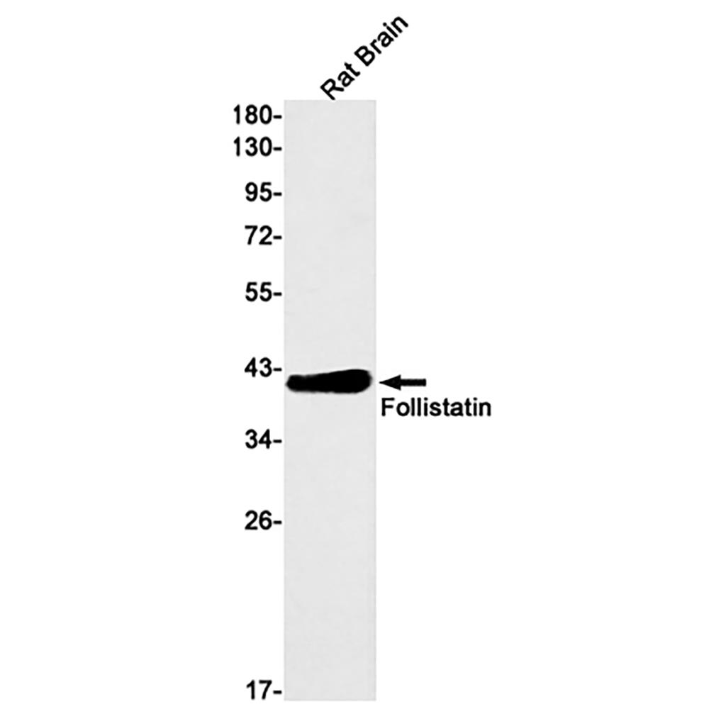 Follistatin (5U17)兔单抗,Follistatin (5U17) Rabbit Monoclonal Antibody