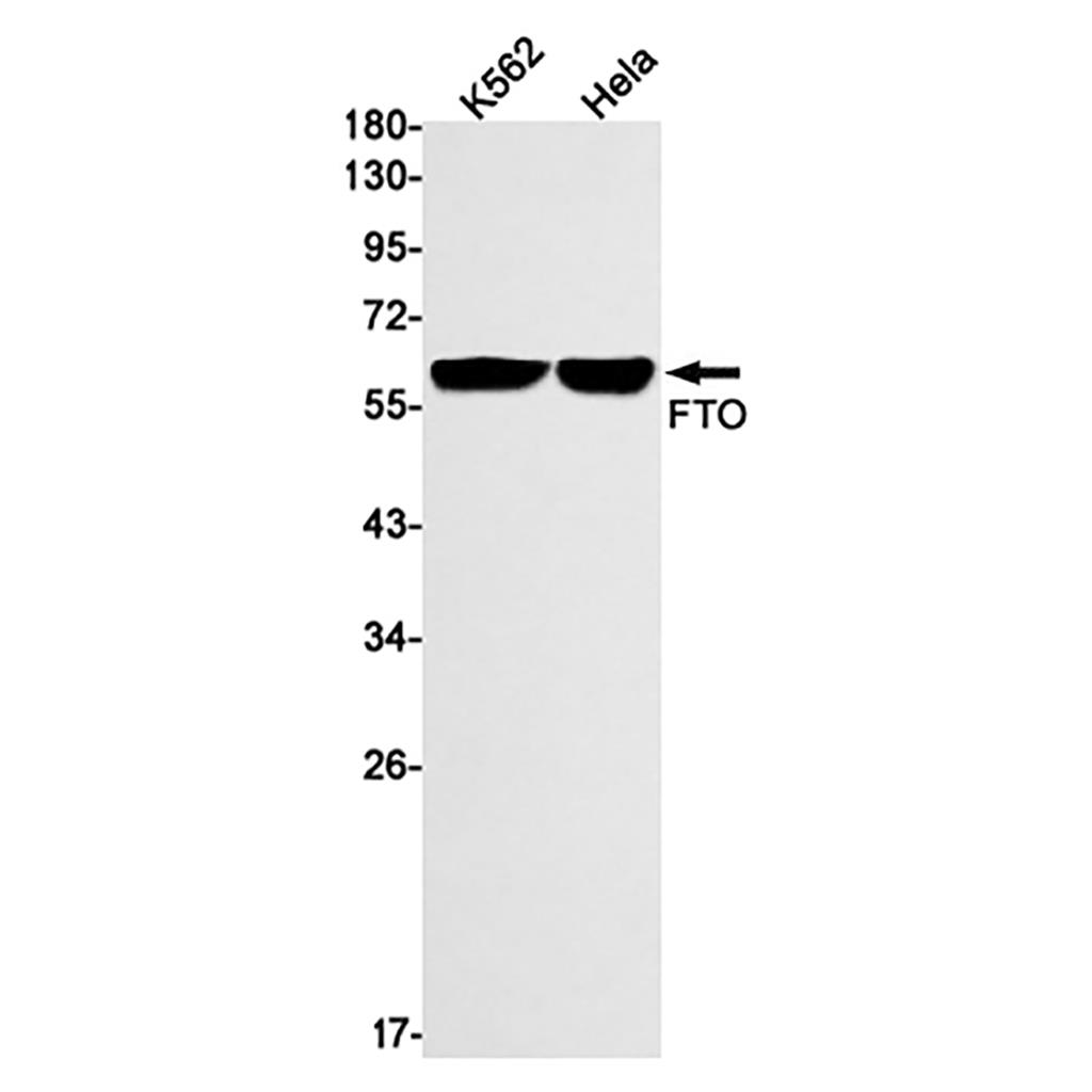 FTO (19W13)兔单抗,FTO (19W13) Rabbit Monoclonal Antibody