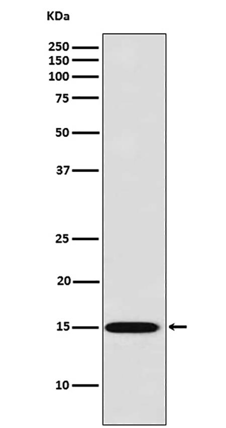 Galectin 7 (11B9)兔单抗,Galectin 7 (11B9) Rabbit Monoclonal Antibody