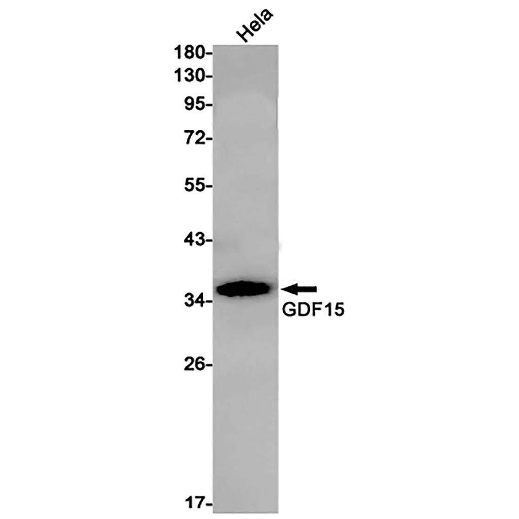 GDF15 (6F3)兔单抗,GDF15 (6F3) Rabbit Monoclonal Antibody
