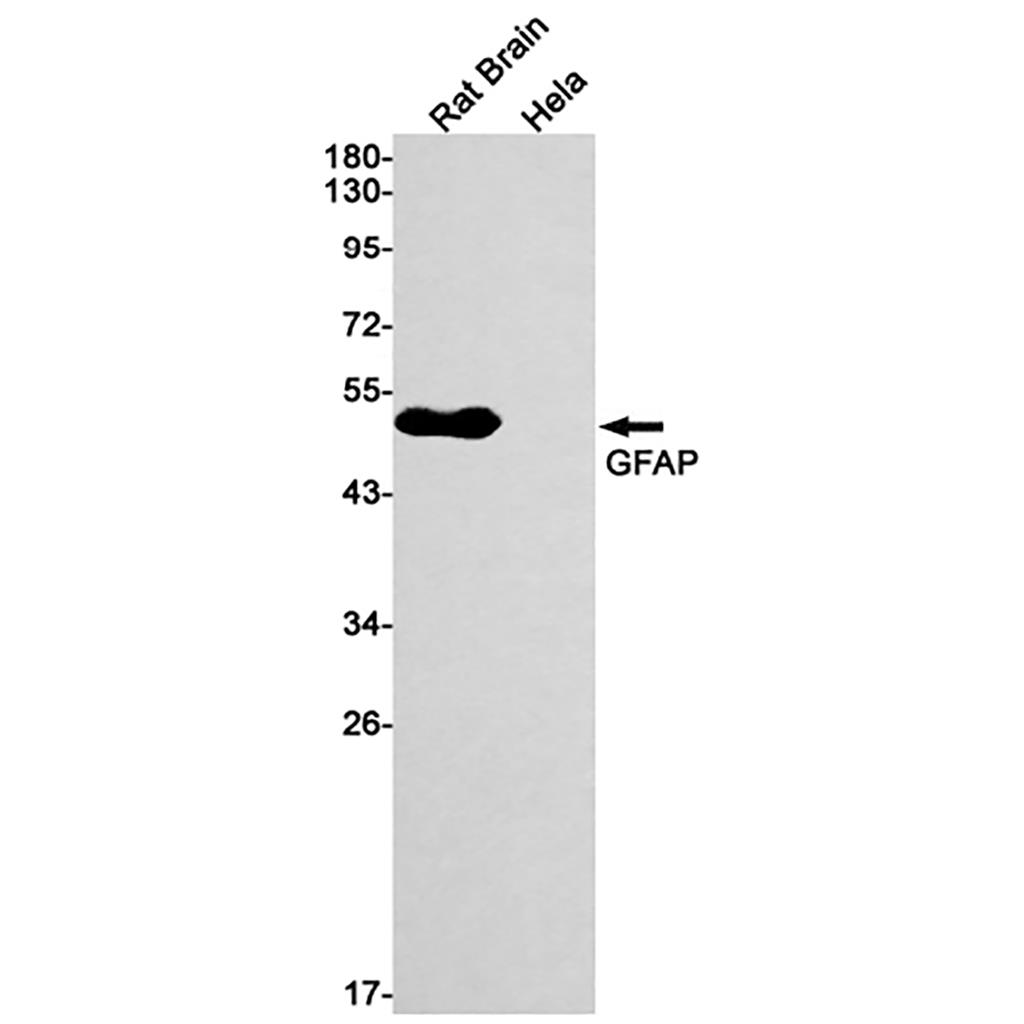 GFAP  (18L1)兔单抗,GFAP  (18L1) Rabbit Monoclonal Antibody