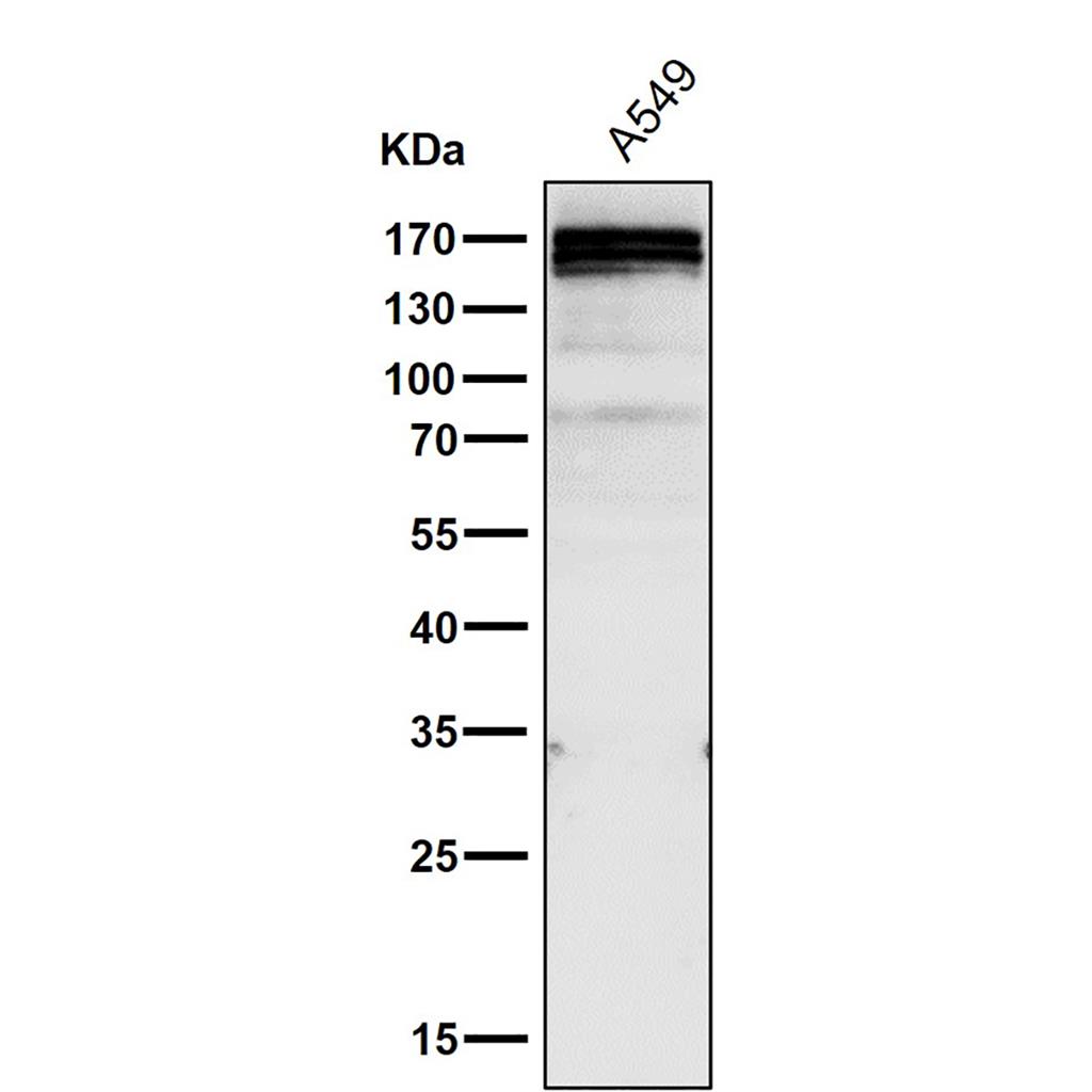 Gli1 (17P5)兔单抗,Gli1 (17P5) Rabbit Monoclonal Antibody