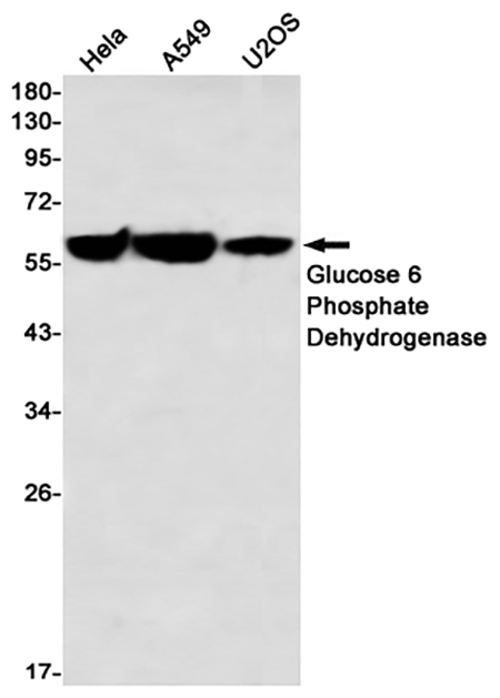Glucose 6 Phosphate Dehydrogenase (5Y1)兔单抗,Glucose 6 Phosphate Dehydrogenase (5Y1) Rabbit Monoclonal Antibody