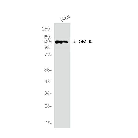 GM130 (6E7)兔单抗,GM130 (6E7) Rabbit Monoclonal Antibody