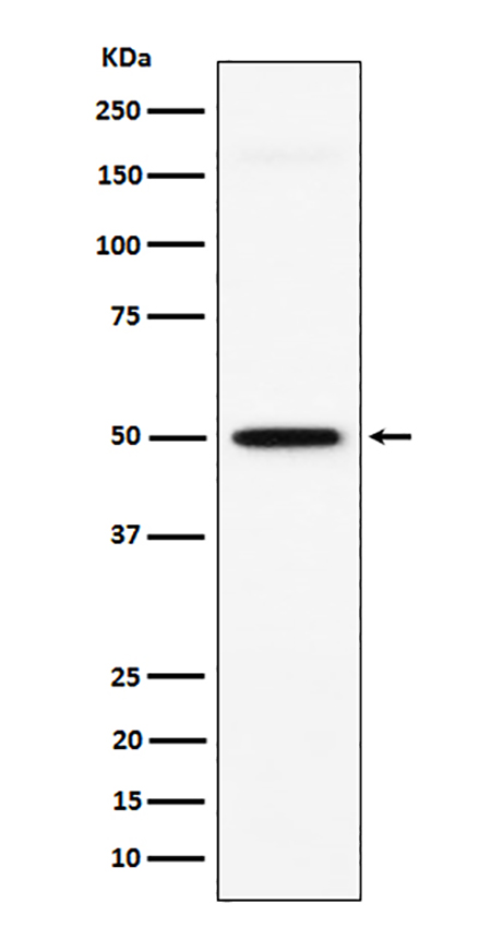 GPA33 (3I9)兔单抗,GPA33 (3I9) Rabbit Monoclonal Antibody
