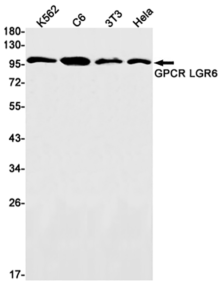 GPCR / LGR6 (5S15)兔单抗,GPCR / LGR6 (5S15) Rabbit Monoclonal Antibody