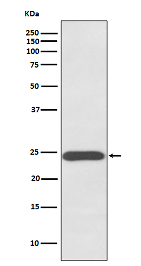 Growth Hormone (12Z11)兔单抗,Growth Hormone (12Z11) Rabbit Monoclonal Antibody