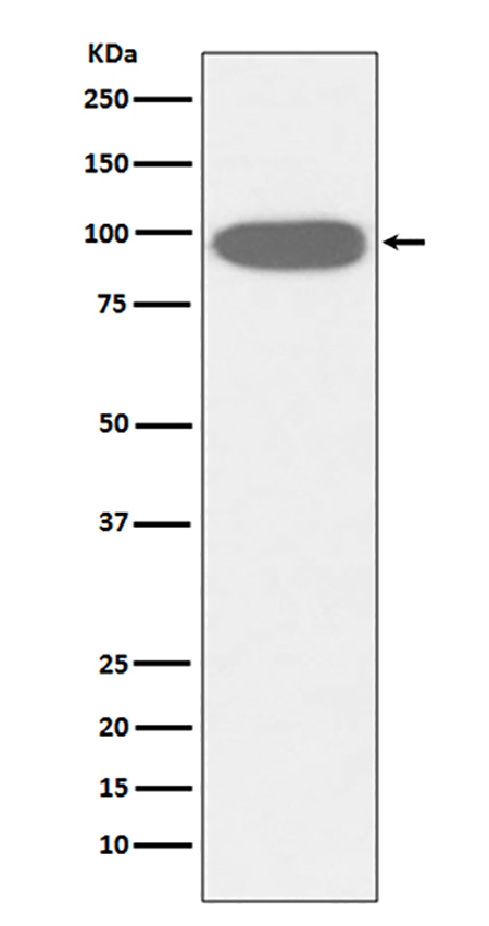 GRP94 (2K1)兔单抗,GRP94 (2K1) Rabbit Monoclonal Antibody