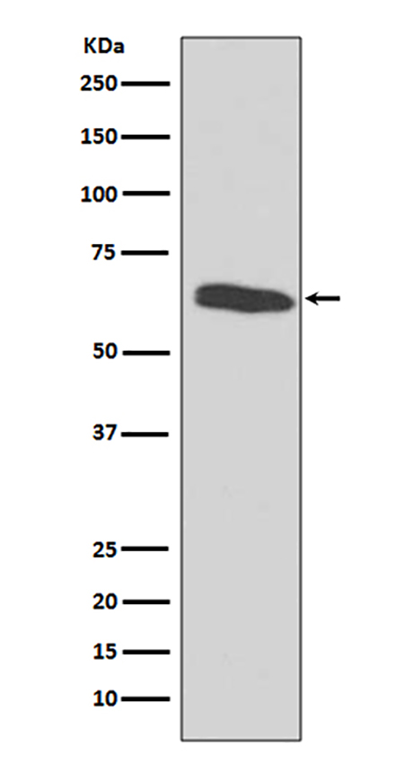 HDAC2 (7L9)兔单抗,HDAC2 (7L9) Rabbit Monoclonal Antibody