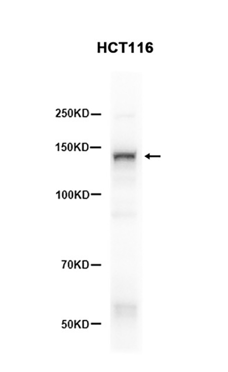 HDAC4 (14G14)兔单抗,HDAC4 (14G14) Rabbit Monoclonal Antibody