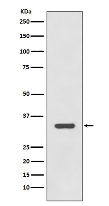 HLA-DRA (4K6)兔单抗,HLA-DRA (4K6) Rabbit Monoclonal Antibody