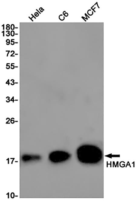 HMGA1 (13B3)兔单抗,HMGA1 (13B3) Rabbit Monoclonal Antibody
