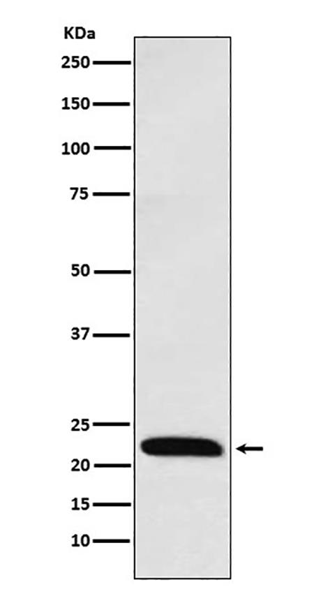 ICOS (16D3)兔单抗,ICOS (16D3) Rabbit Monoclonal Antibody