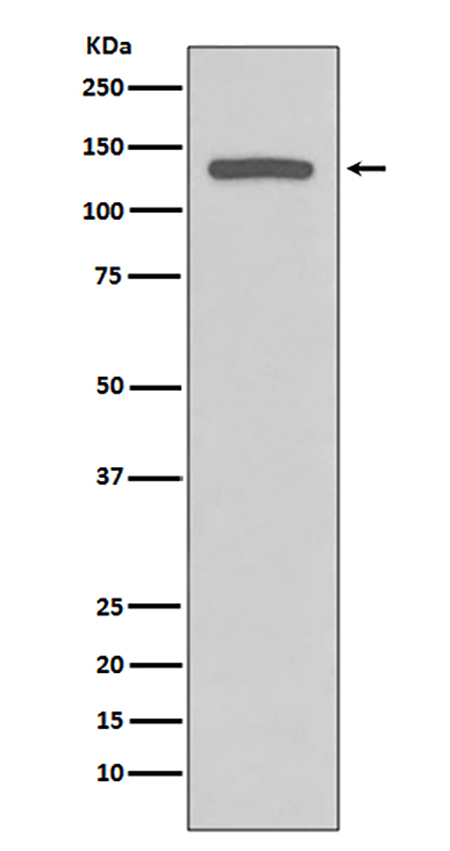 iNOS (12H16)兔单抗,iNOS (12H16) Rabbit Monoclonal Antibody