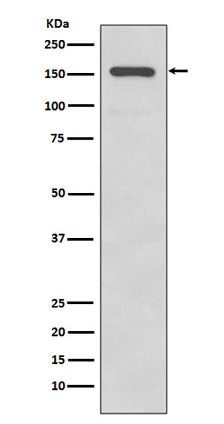 Integrin alpha 2 (19O18)兔单抗,Integrin alpha 2 (19O18) Rabbit Monoclonal Antibody