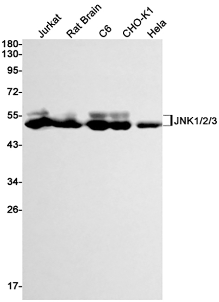 JNK (19C18)兔单抗,JNK (19C18) Rabbit Monoclonal Antibody