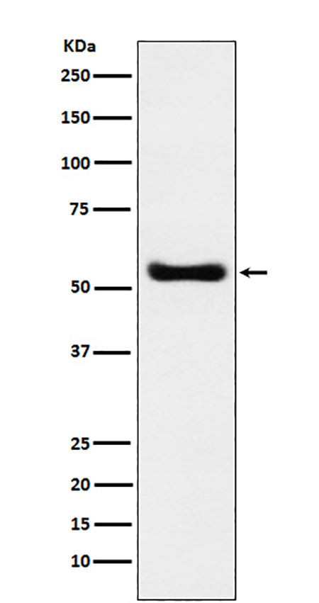 KAT8 / MYST1 / MOF (9E16)兔单抗,KAT8 / MYST1 / MOF (9E16) Rabbit Monoclonal Antibody