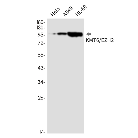 KMT6 / EZH2 (15A18)兔单抗,KMT6 / EZH2 (15A18) Rabbit Monoclonal Antibody