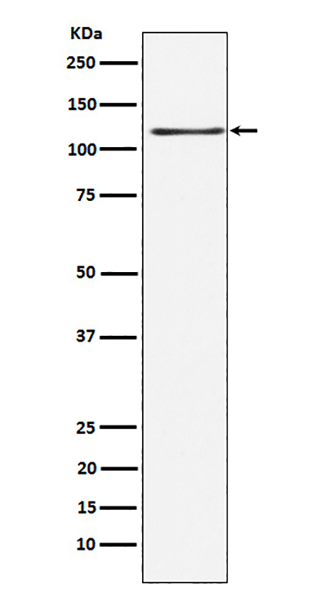 KSR1 (5X11)兔单抗,KSR1 (5X11) Rabbit Monoclonal Antibody