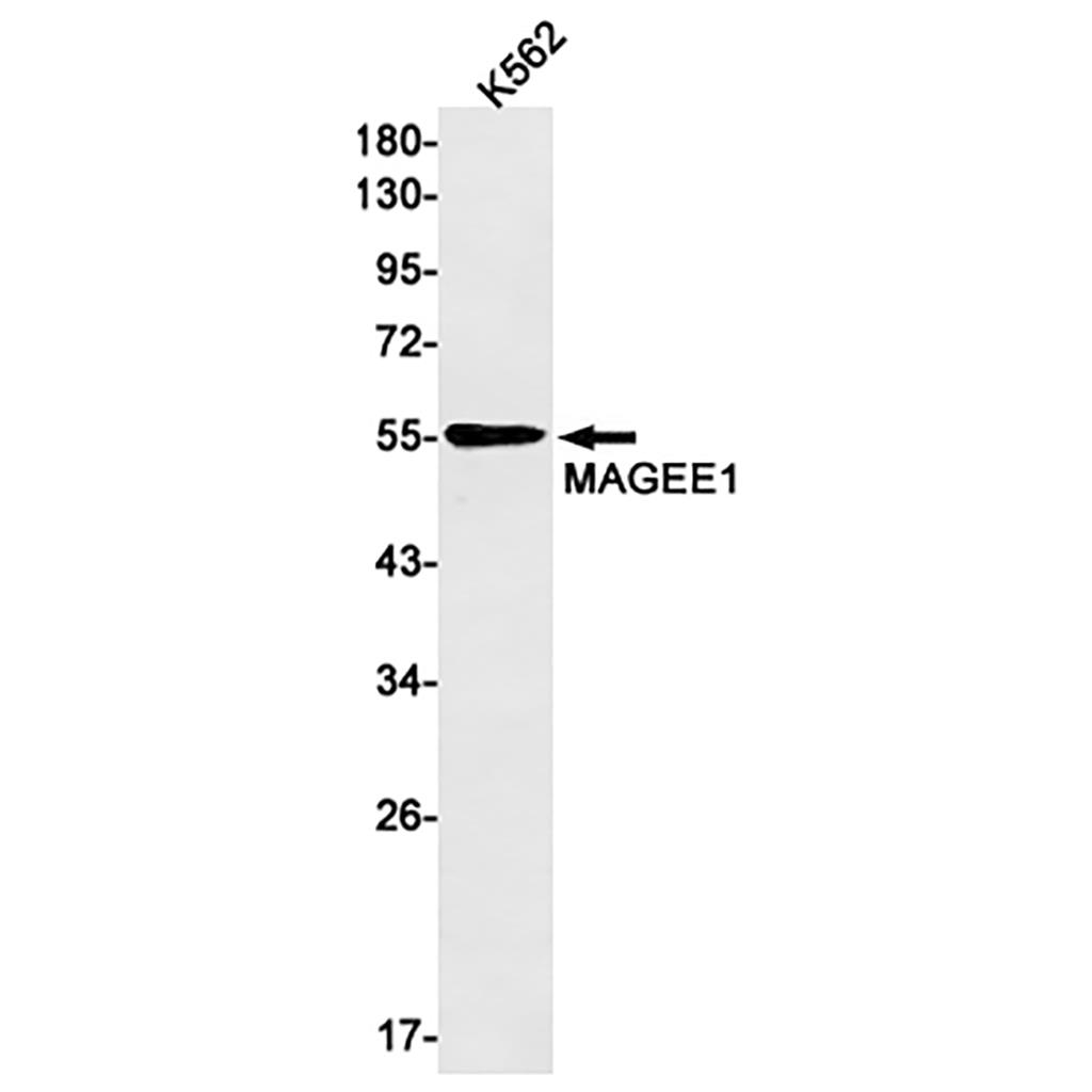 MAGEC2 (3A19)兔单抗,MAGEC2 (3A19) Rabbit Monoclonal Antibody