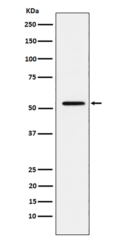 MMP1 (7T4)兔单抗,MMP1 (7T4) Rabbit Monoclonal Antibody