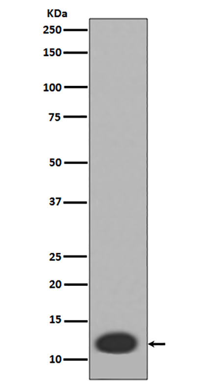 MRP8 (16L5)兔单抗,MRP8 (16L5) Rabbit Monoclonal Antibody