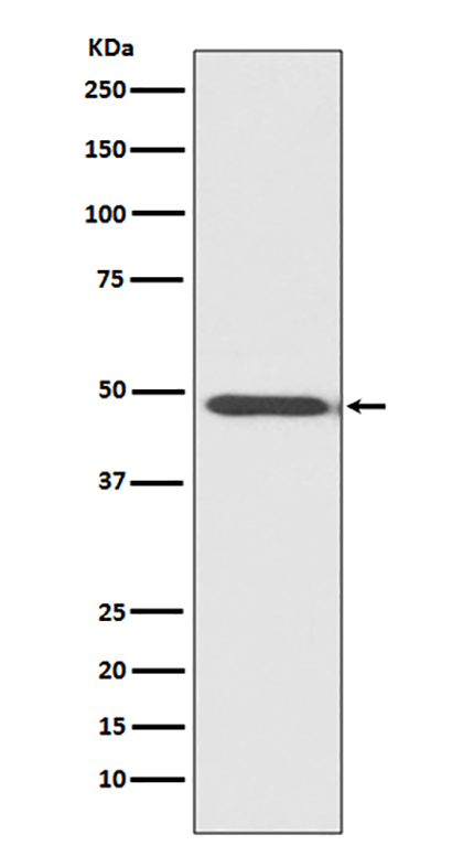 MyoD1 (5M4)兔单抗,MyoD1 (5M4) Rabbit Monoclonal Antibody