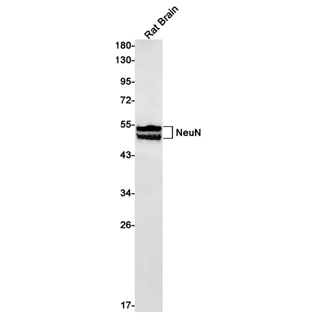 NeuN (11E16)兔单抗,NeuN (11E16) Rabbit Monoclonal Antibody
