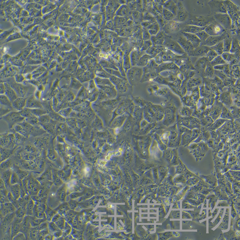 NTERA-2 cl.D1（人睾丸癌细胞）YB-71818HC,NTERA-2 cl.D1