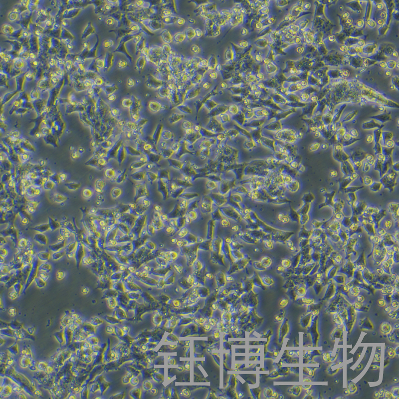 MN9D（小鼠中脑多巴胺能神经元细胞）YB-7041MC,MN9D