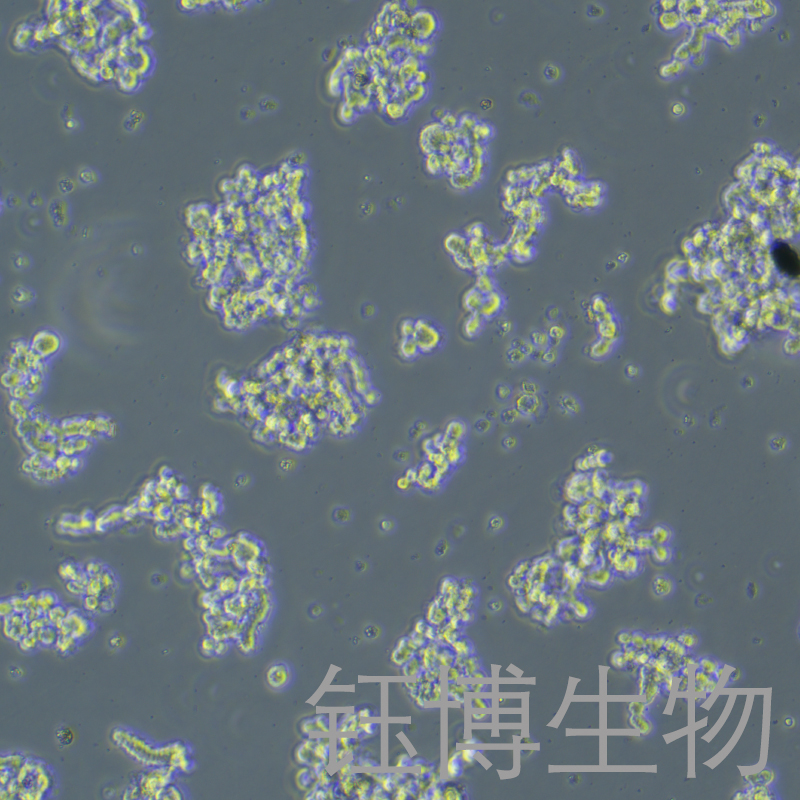 Y79（人视网膜母细胞瘤）YB-71825HC,Y79