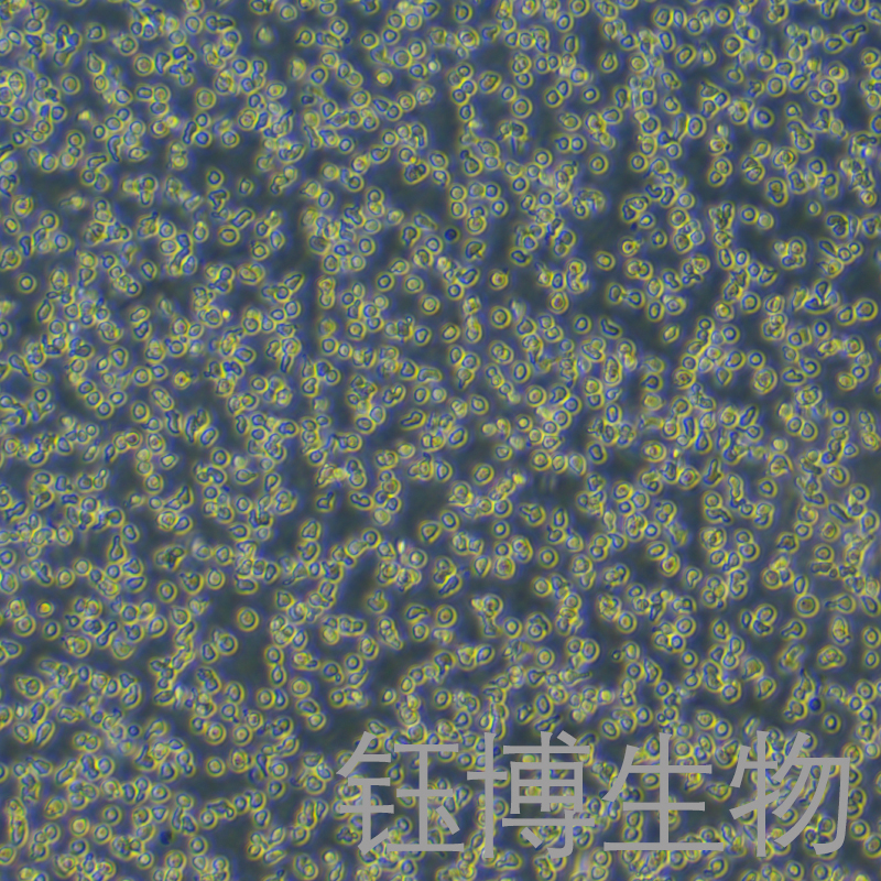 OCI-LY19（人B细胞淋巴瘤）YB-71829HC,OCI-LY19