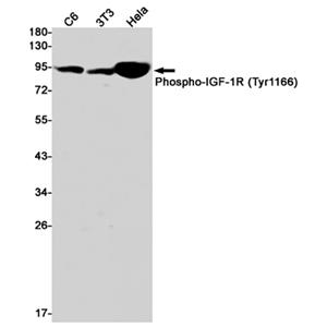 Phospho-IGF1 Receptor (Tyr1166)兔单抗,Phospho-IGF1 Receptor (Tyr1166) Rabbit Monoclonal Antibody