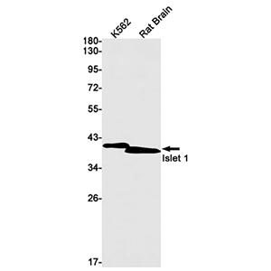 Islet 1兔单抗,Islet 1 Rabbit Monoclonal Antibody