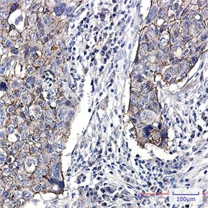 Junctional Adhesion Molecule 1兔单抗,Junctional Adhesion Molecule 1 Rabbit Monoclonal Antibody