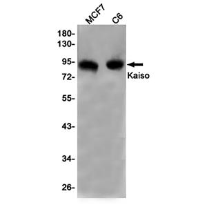 Kaiso兔单抗,Kaiso Rabbit Monoclonal Antibody