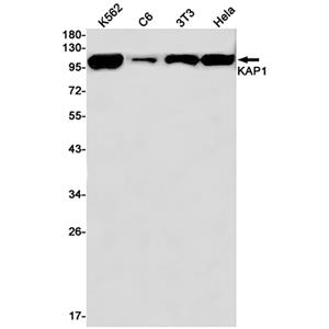 KAP1兔单抗,KAP1 Rabbit Monoclonal Antibody