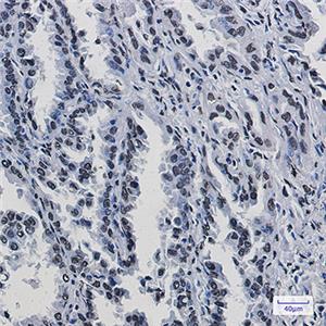 KAP1兔单抗,KAP1 Rabbit Monoclonal Antibody