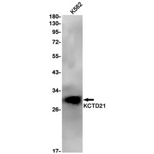 KCTD21兔单抗,KCTD21 Rabbit Monoclonal Antibody