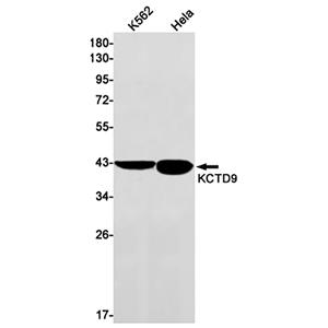 KCTD9兔单抗,KCTD9 Rabbit Monoclonal Antibody