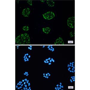 KCTD9兔单抗,KCTD9 Rabbit Monoclonal Antibody