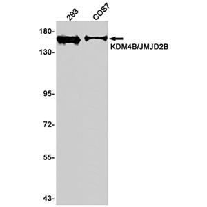 KDM4B兔单抗,KDM4B Rabbit Monoclonal Antibody