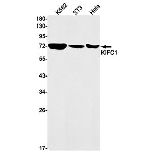 KIFC1兔单抗,KIFC1 Rabbit Monoclonal Antibody