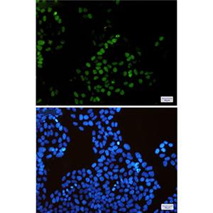 KIFC1兔单抗,KIFC1 Rabbit Monoclonal Antibody