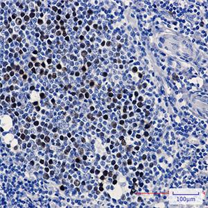 KIFC1兔单抗,KIFC1 Rabbit Monoclonal Antibody