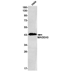 MAGEA3兔单抗,MAGEA3 Rabbit Monoclonal Antibody