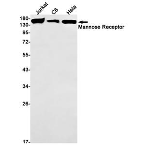 Mannose Receptor兔单抗,Mannose Receptor Rabbit Monoclonal Antibody