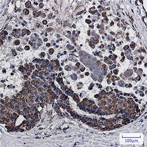 MDH2兔单抗,MDH2 Rabbit Monoclonal Antibody